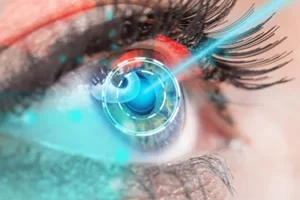 lasik göz çizdirme ameliyatı