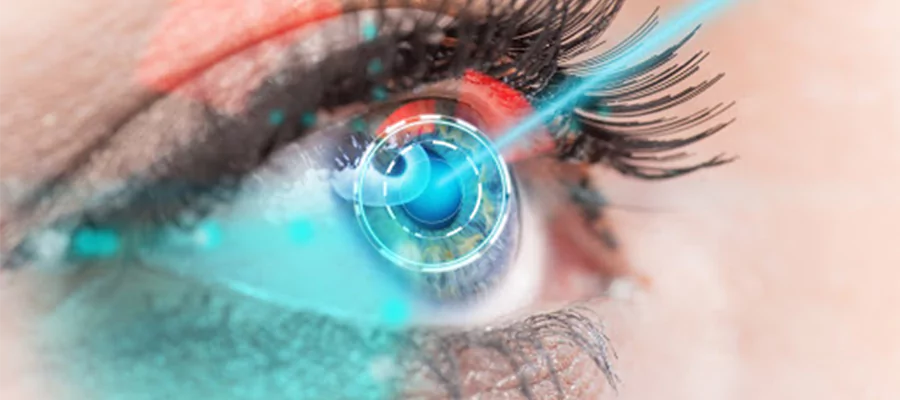 lasik göz çizdirme ameliyatı