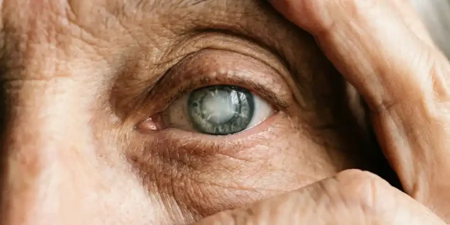 Gözde Katarakt Varsa Ne Olur